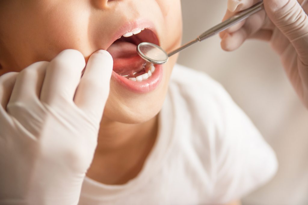 Zahnarzt Itzehoe - Untersuchung des Gebisses eines Kindes